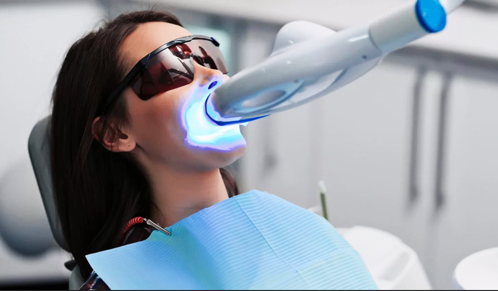 Bleaching Tekniği ile Gülüşünüze Güvenin