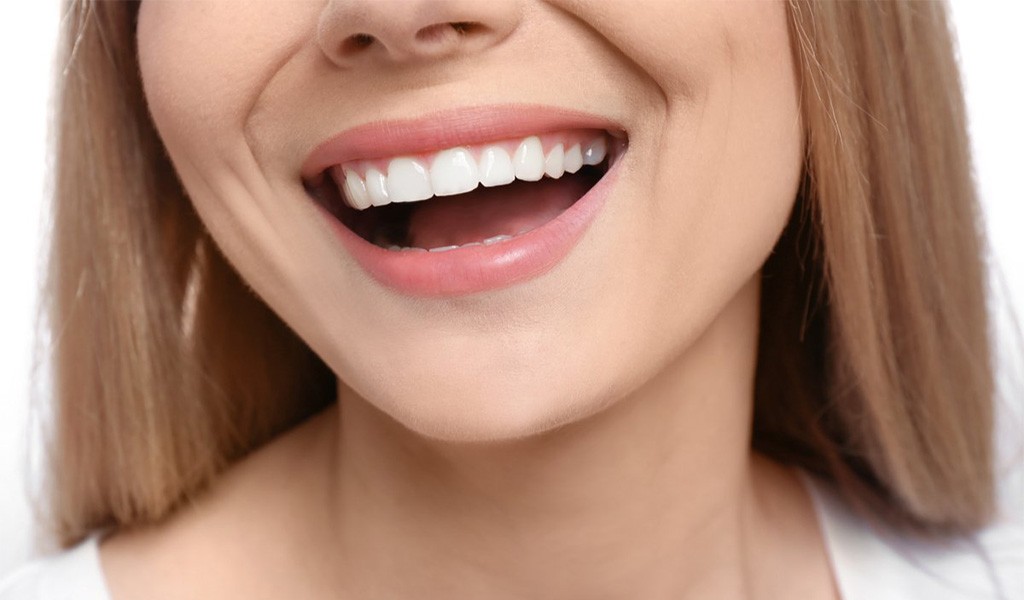 Dijital Gülüş Tasarımı Nedir ?